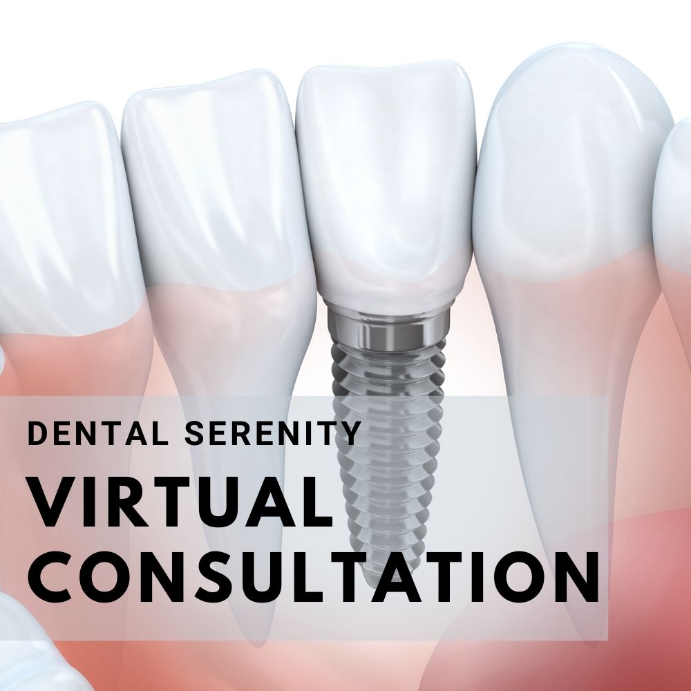 Virtual Consultation: 20 minutes - Esthetics/Implants